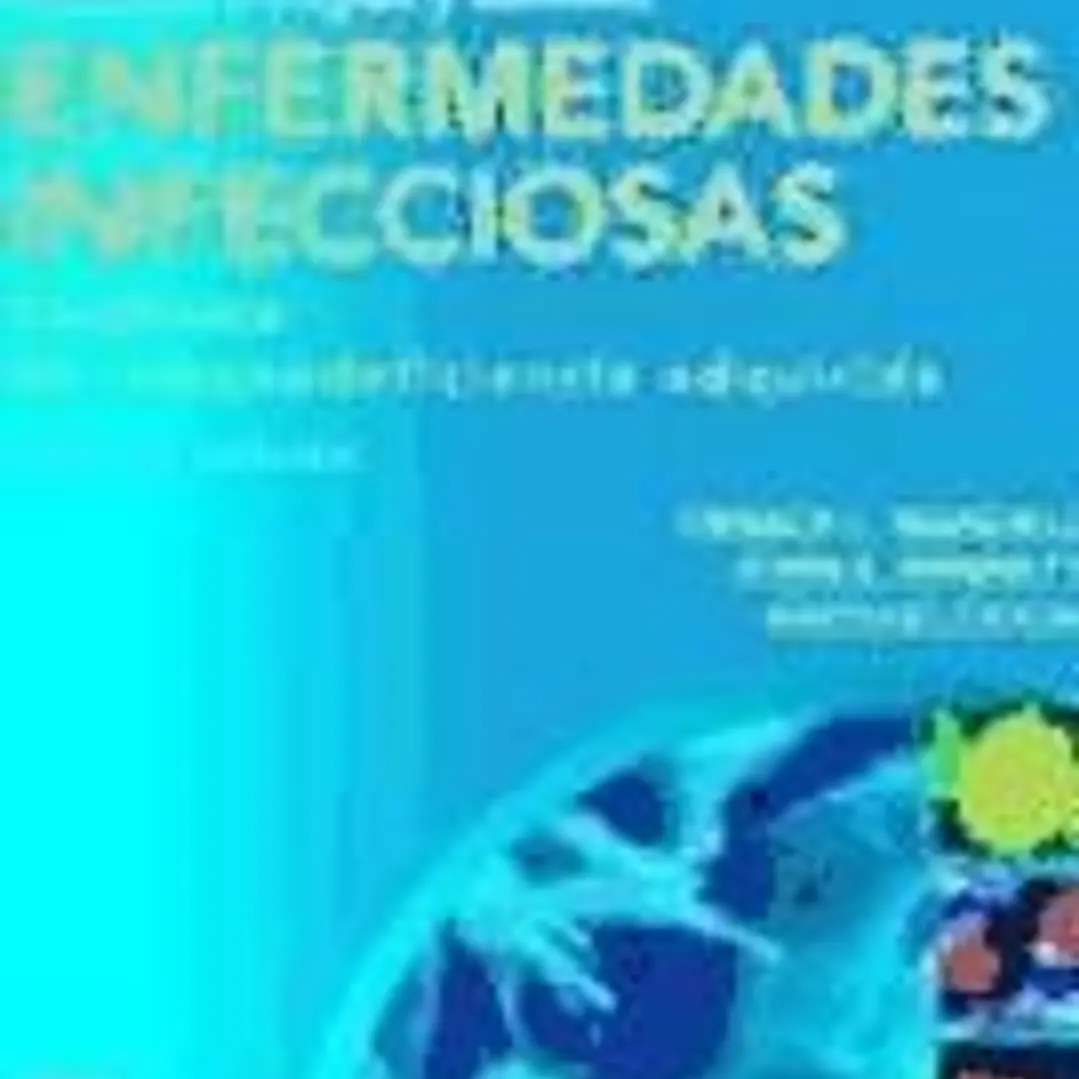 Enfermedades infecciosas: Sindrome de inmunodeficiencia adquirida 1