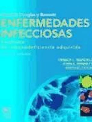 Enfermedades infecciosas: Sindrome de inmunodeficiencia adquirida