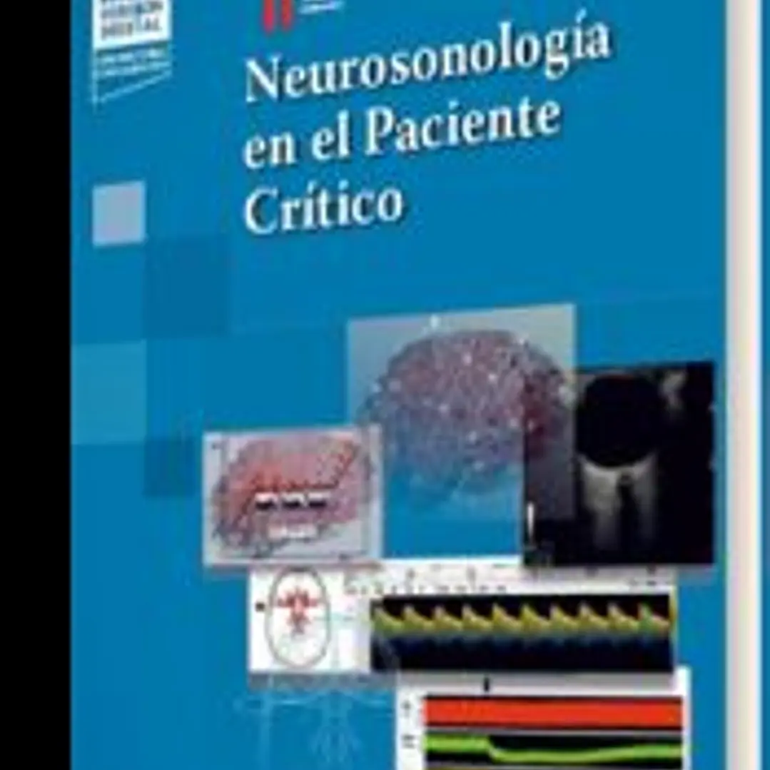 Neurosonología en el Paciente Crítico 1