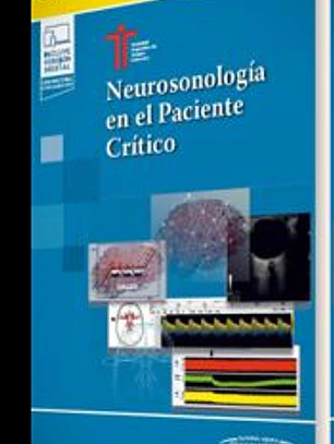 Neurosonología en el Paciente Crítico
