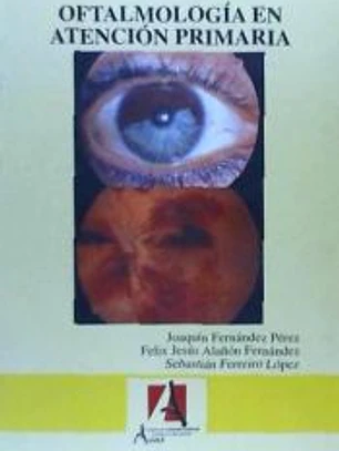 Oftalmología en atención primaria