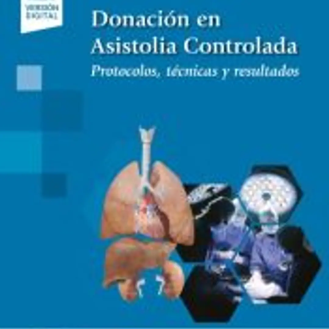 Donación en Asistolia Controlada 1