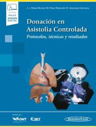 Donación en Asistolia Controlada