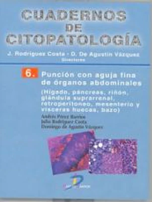 Punción con aguja fina de órganos abdominales. Nº 6