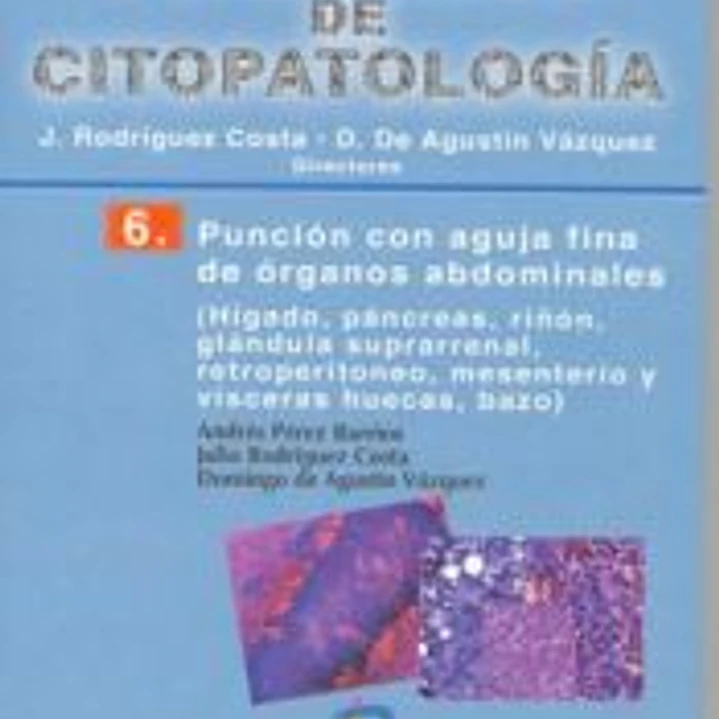 Punción con aguja fina de órganos abdominales. Nº 6 1