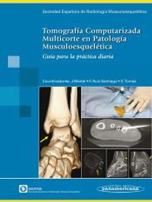 Tomografía Computarizada Multicorte en Patología Musculoesquelética. Guía para la práctica diaria