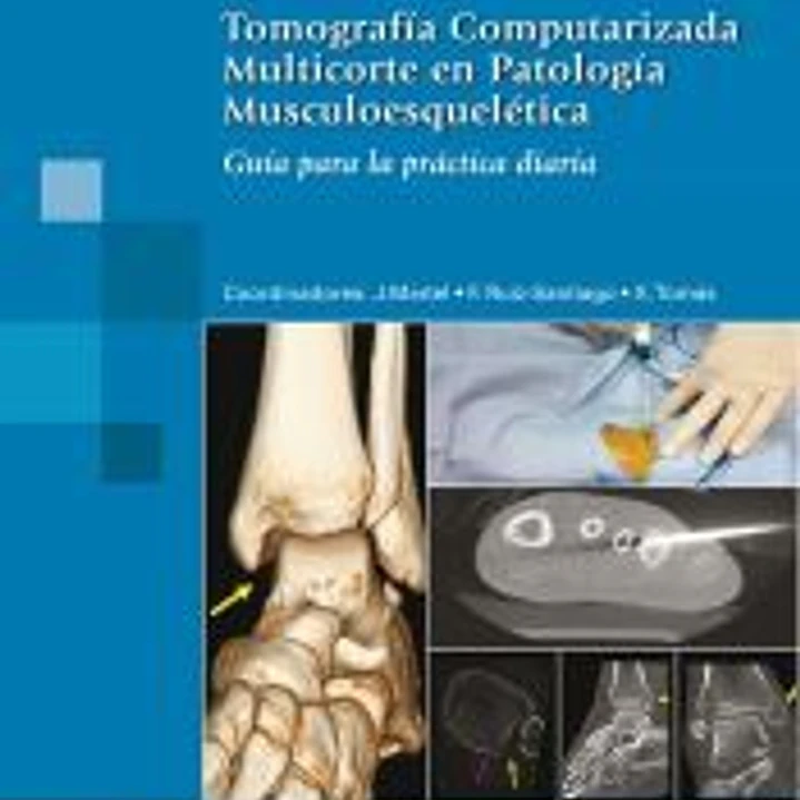 Tomografía Computarizada Multicorte en Patología Musculoesquelética. Guía para la práctica diaria 1