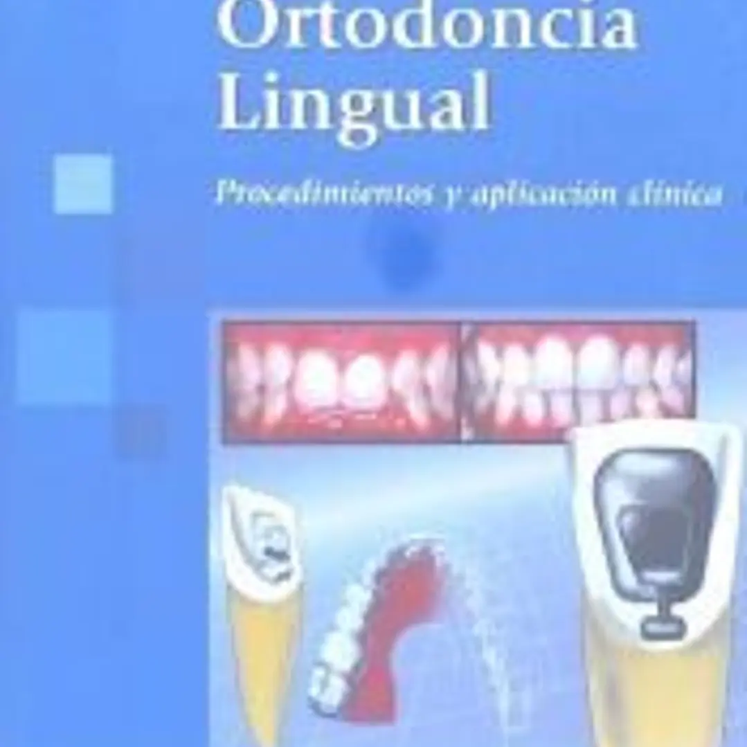Ortodoncia Lingual 1