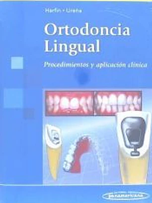Ortodoncia Lingual