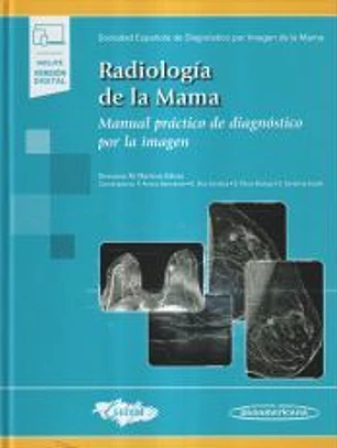 TRATADO DE RADIOLOGIA DE LA MAMA