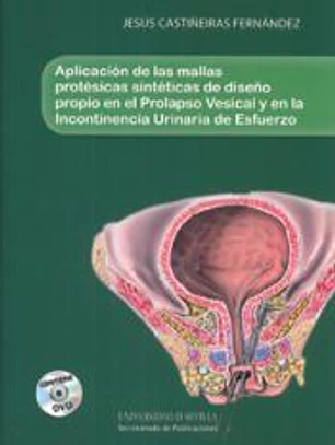 Aplicación de las mallas protésicas sintéticas de diseño propio en el prolapsi vesical y en la incotinencia urinaria de esfuerzo