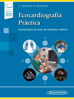 Ecocardiografía práctica