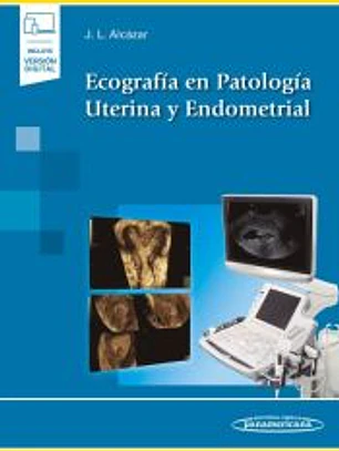 Ecografía en Patología Uterina y Endometrial