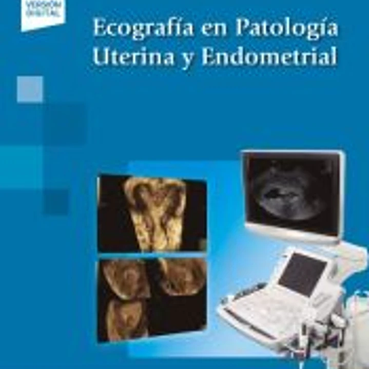 Ecografía en Patología Uterina y Endometrial 1