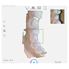 IOS 2 | Escaner Oral | RAY 7