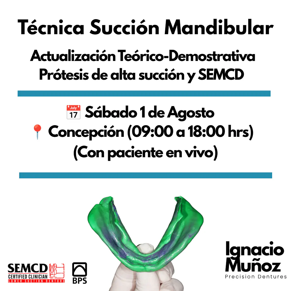 Actualización Teórica-Demostrativa Prótesis alta succión y SEMCD. Concepción  1