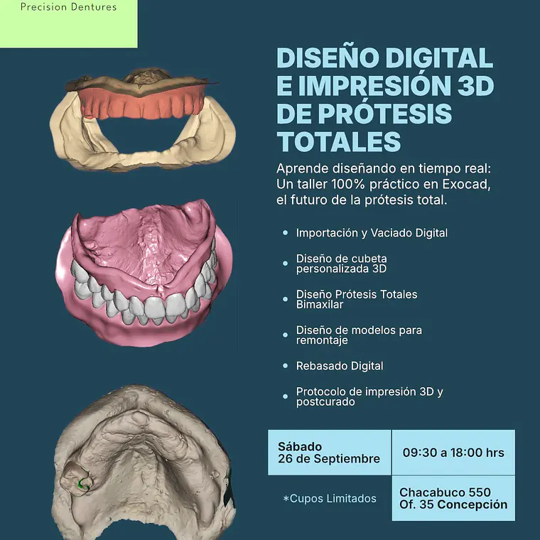 Diseño digital e impresión 3D de Prótesis Totales - 26 Septiembre 1