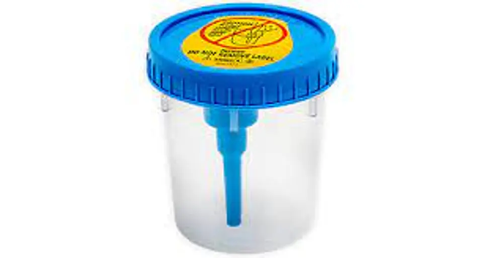 FRASCO RECOLECCION DE ORINA 2