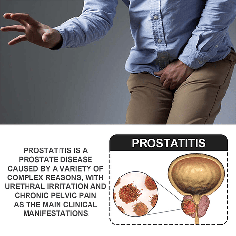 30 Parches Tratamiento Próstata (prostatitis) South moon