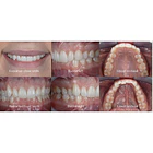 Godox MF12-DK1 Flash Macro Dental Para Dentistas Compatible Con Cámaras Sony 8