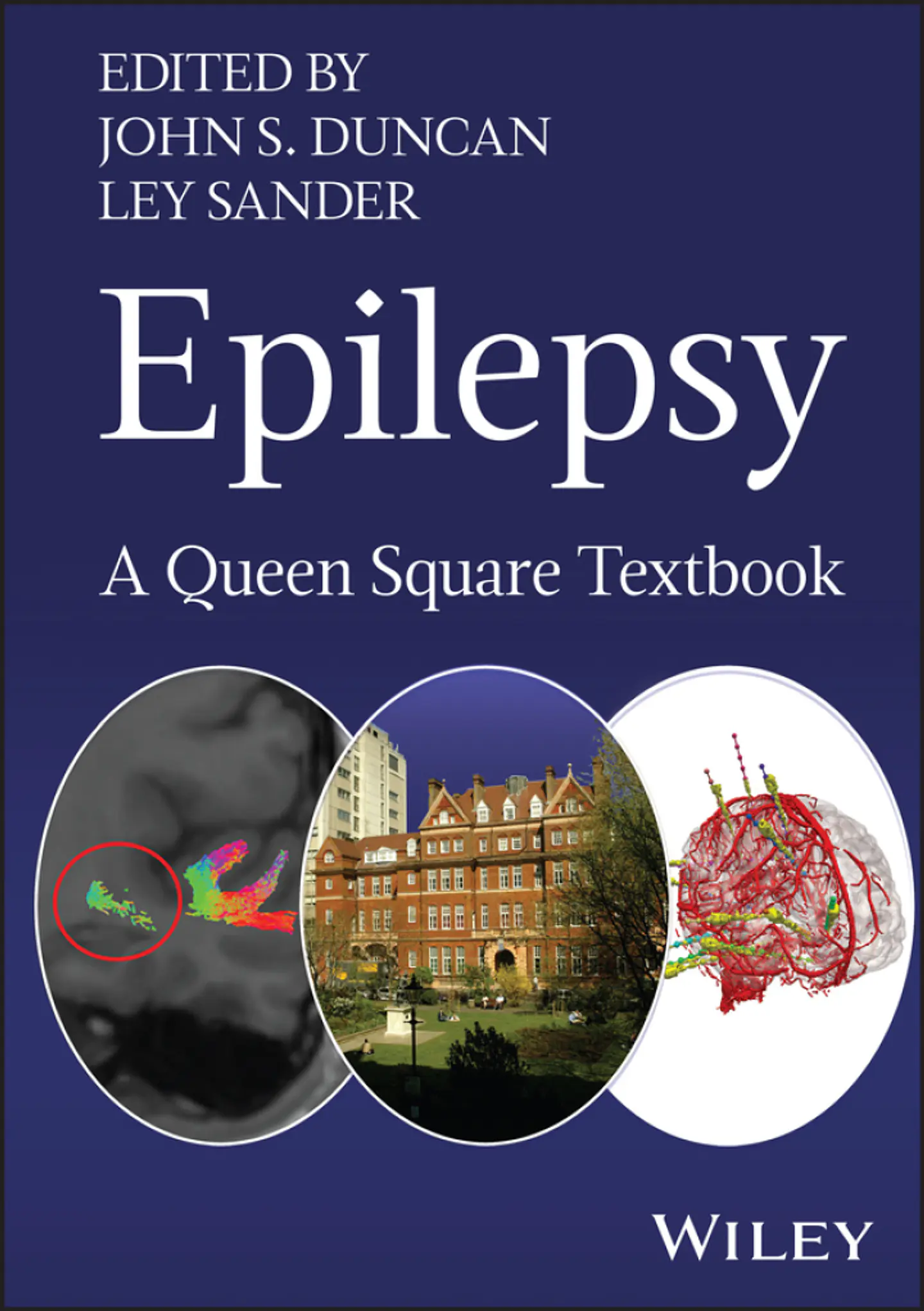Epilepsy: A Queen Square Textbook 1