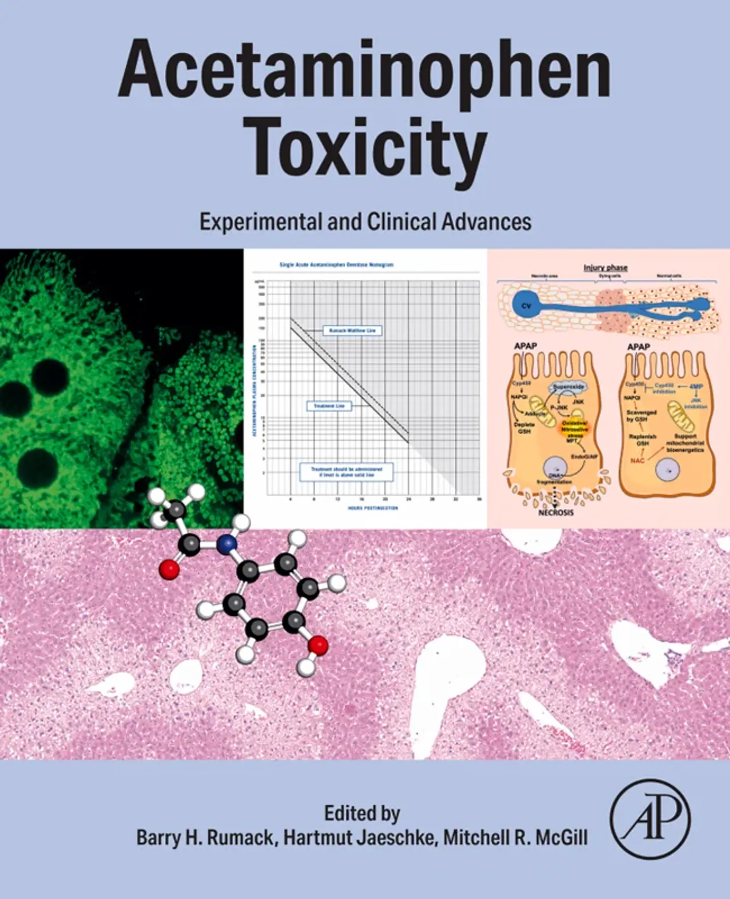 Acetaminophen Toxicity: Experimental and Clinical Advances 1
