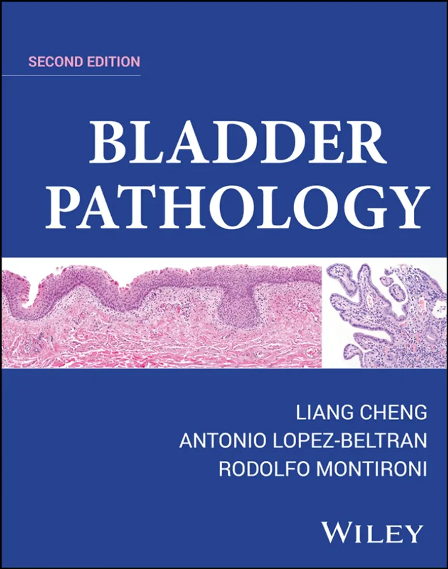 Bladder Pathology 2nd Edition 1