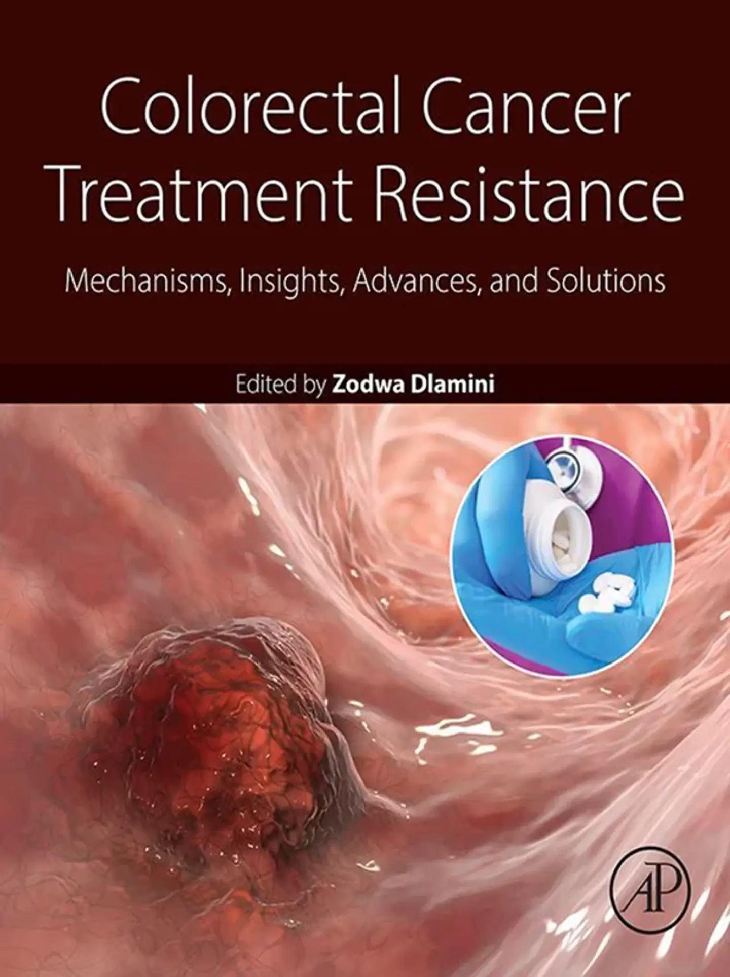 Colorectal Cancer Treatment Resistance: Mechanisms, Insights, Advances, and Solutions 1