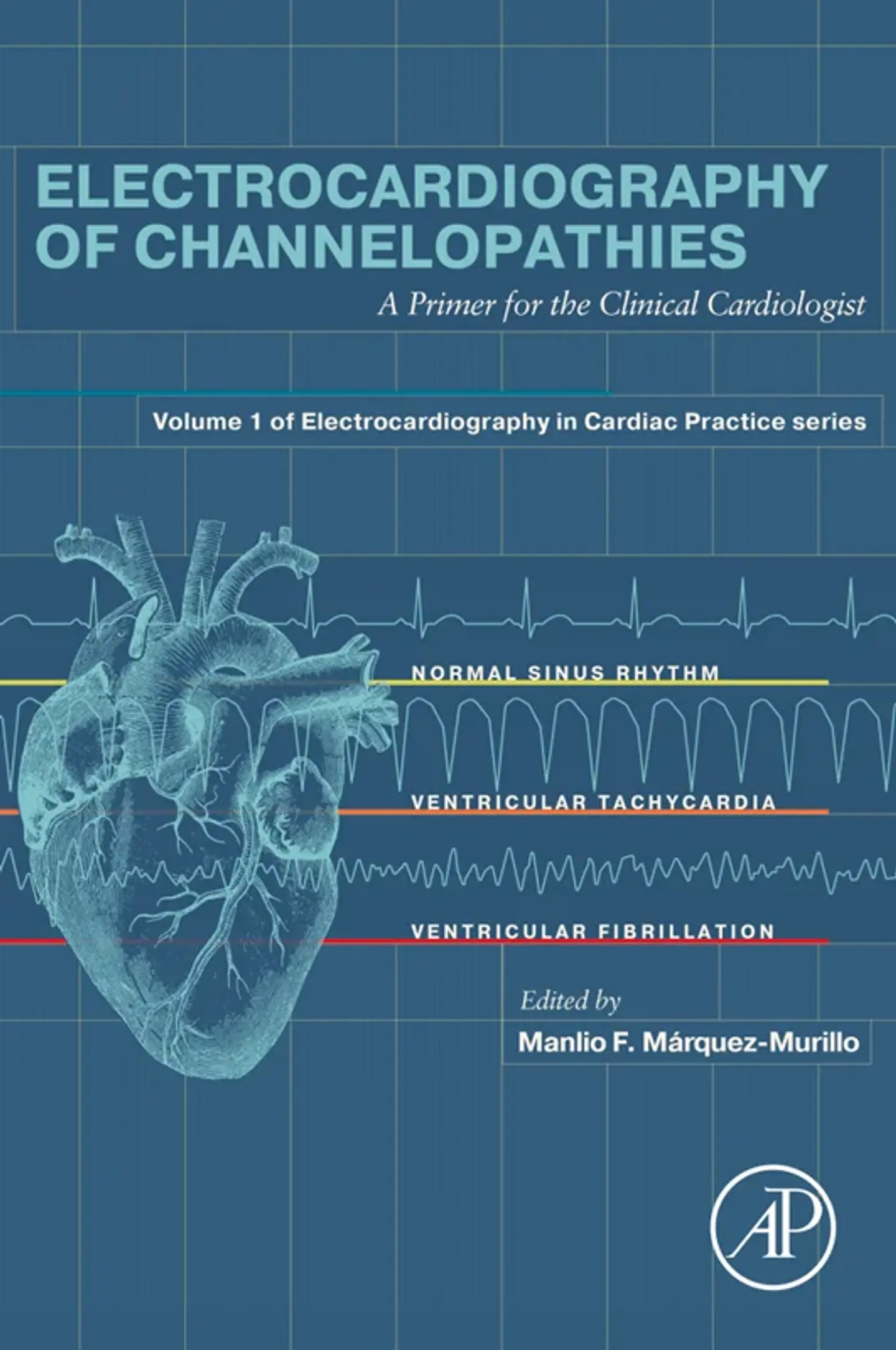 Electrocardiography of Channelopathies: A Primer for the Clinical Cardiologist 1