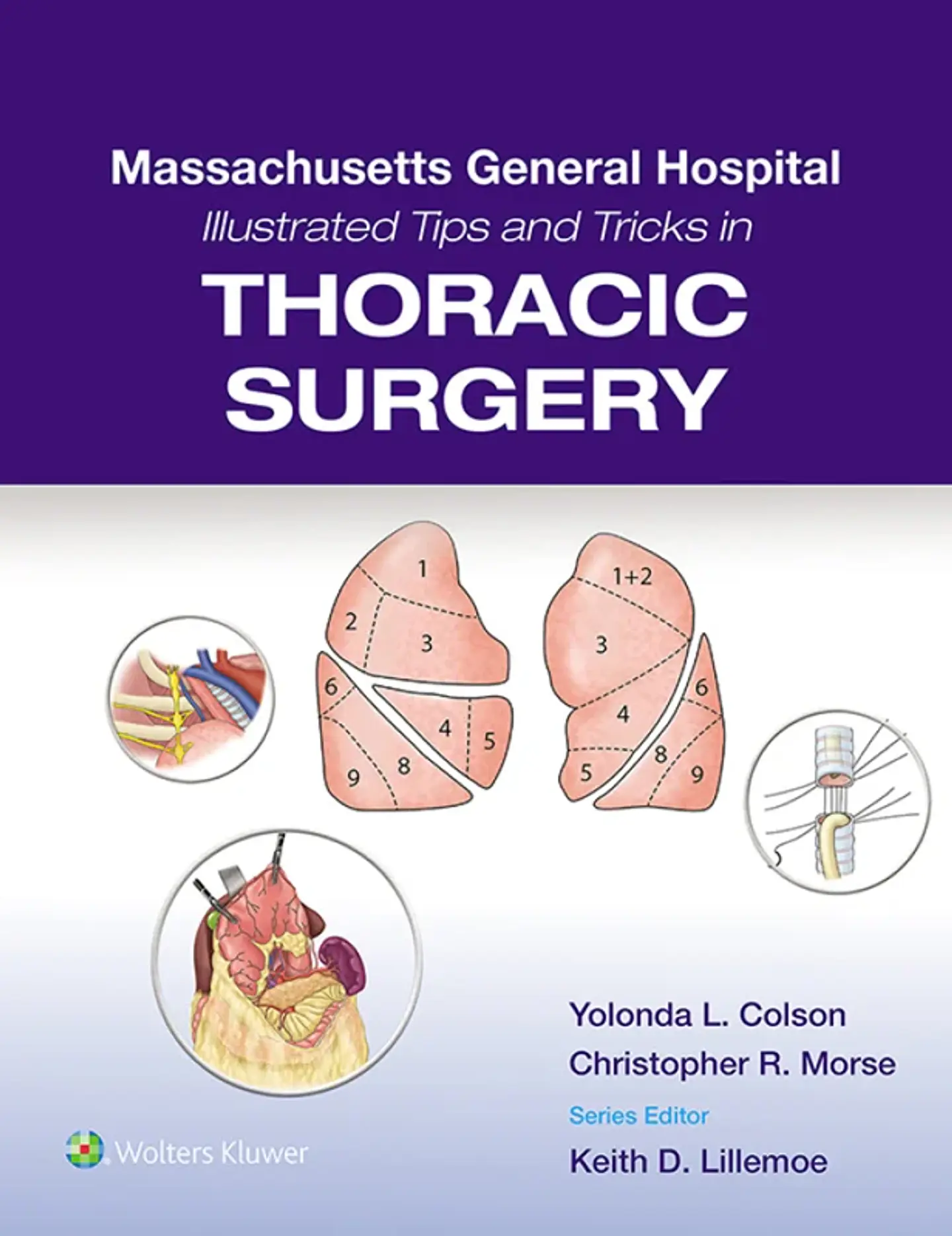 Massachusetts General Hospital Illustrated Tips and Tricks in Thoracic Surgery 1