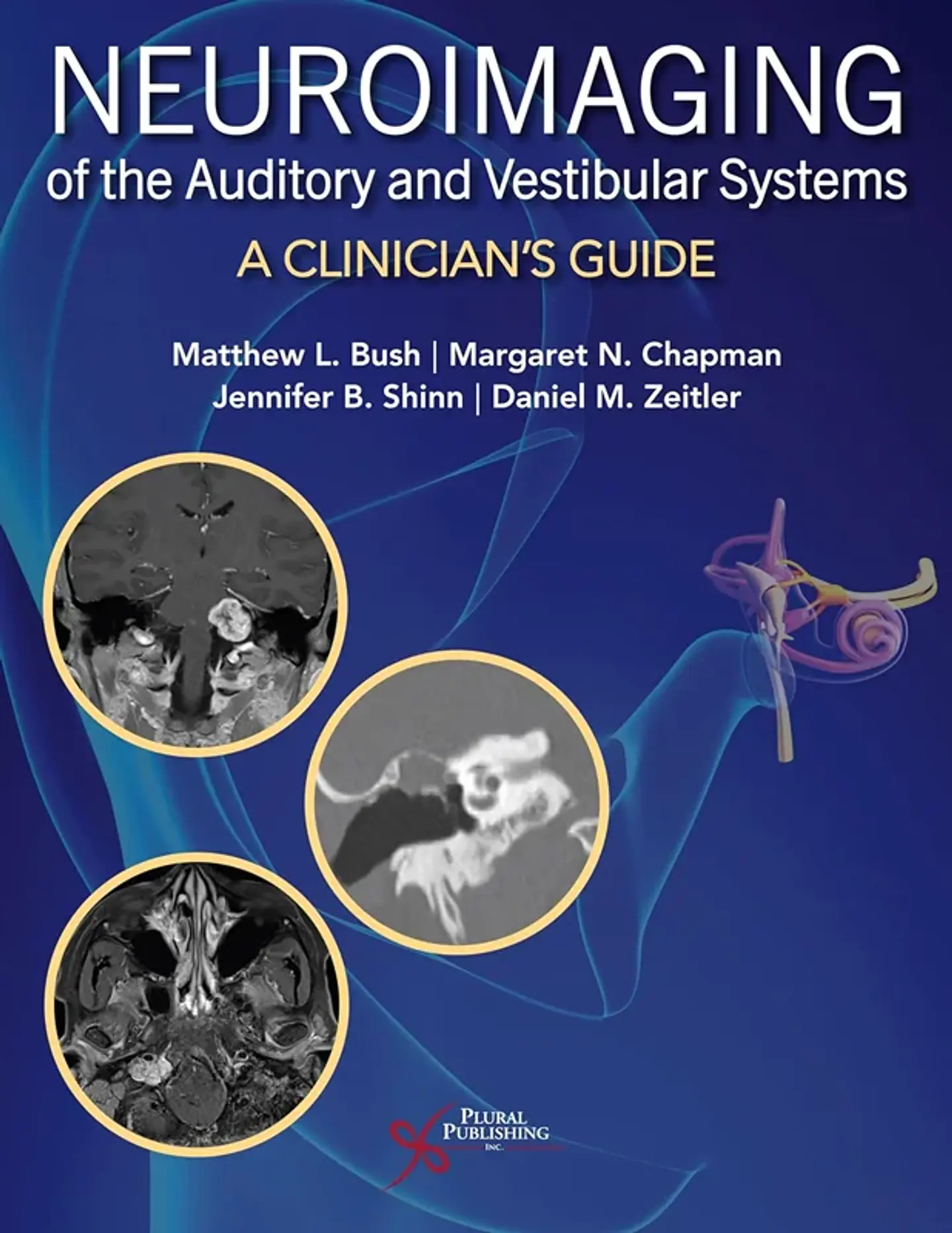 Neuroimaging of the Auditory and Vestibular Systems: A Clinician’s Guide 1
