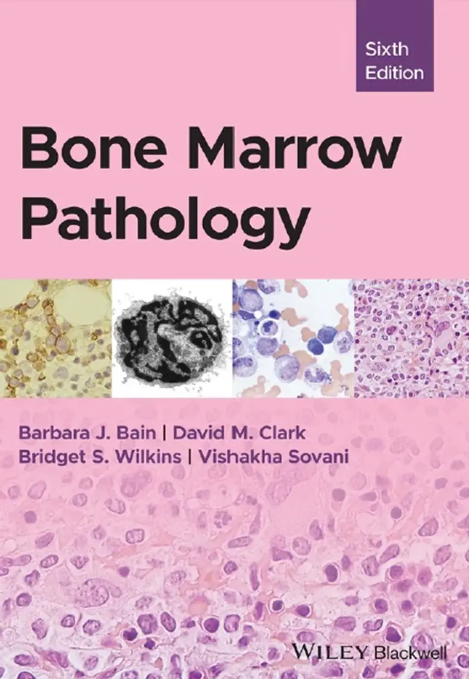 Bone Marrow Pathology 6th Edition 1