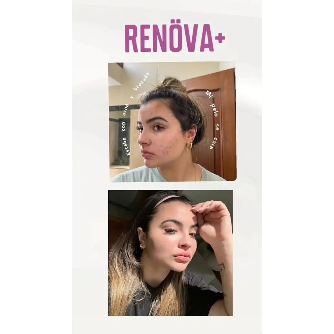 Renöva+ 2.0 Original_Biopeptidos De Colageno + Resveratrol + Biotina FWP 13