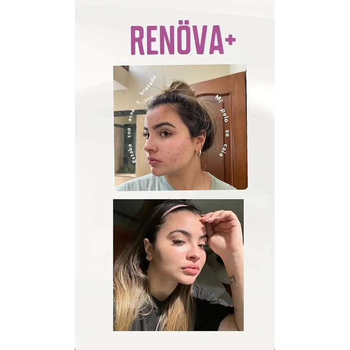 Renöva+ 2.0 Original_Biopeptidos De Colageno + Resveratrol + Biotina FWP 13