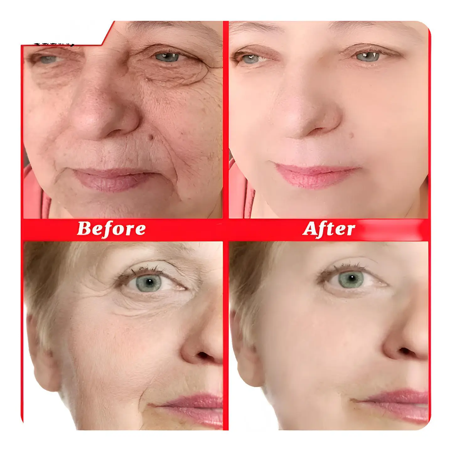 X50 Serum Cápsulas Ácido Hialurónico Suero Facial Antiarruga 2