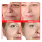 X50 Serum Cápsulas Ácido Hialurónico Suero Facial Antiarruga - Miniatura 2