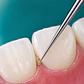 Kit limpieza dental para hilo cero inoxidable - Miniatura 2