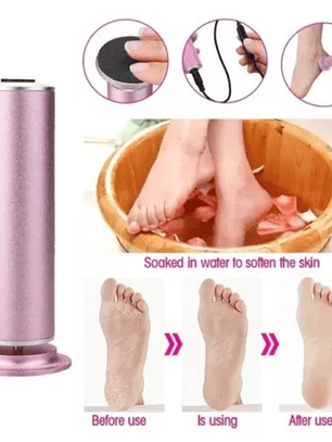 REMOVEDOR DE CALLOS ELÉCTRICO 