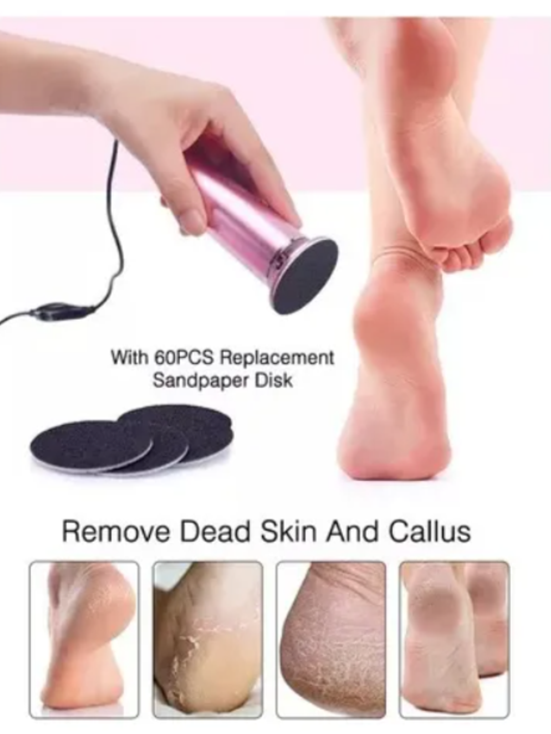 REMOVEDOR DE CALLOS ELÉCTRICO  3