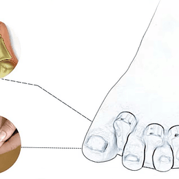 Par Separadores de Silicona para Dedos del Pie