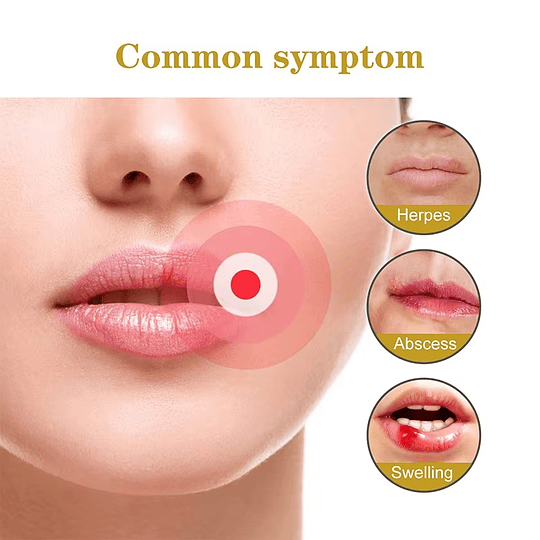 Set 72 Parches para Fuego y Ampollas del Labio