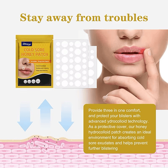 Set 72 Parches para Fuego y Ampollas del Labio