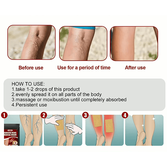 Set 10 Parches Alivio Varices De Las Piernas