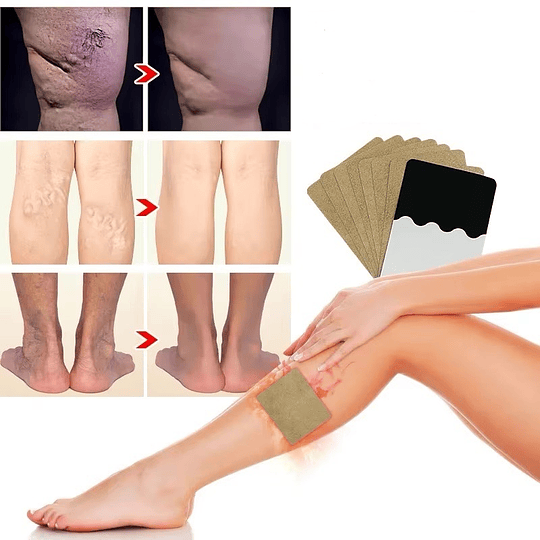 Set 10 Parches Alivio Varices De Las Piernas