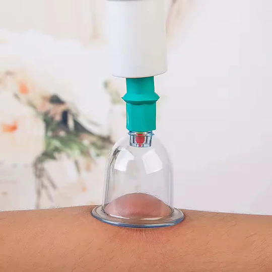 6 Ventosas Tecnica China Elimina Dolores, Celulitis