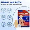 Set de 21 Parches de hidrogel para el tratamiento nocturno de hongos en las uñas 