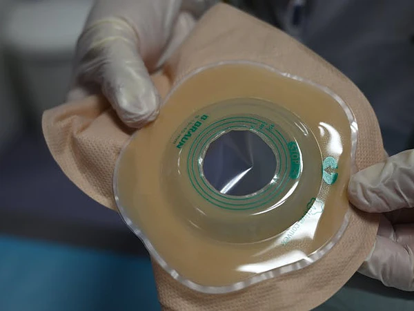 Guía paso a paso para pacientes nuevos en colostomía