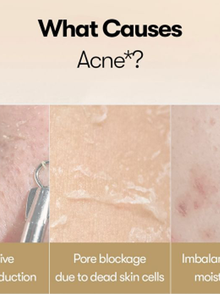 VT - Garlic AC Reedle Shot Spot Cream 2