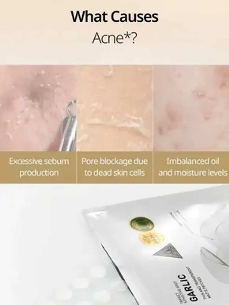 Set Vt Cosmetics Garlic Ac 6