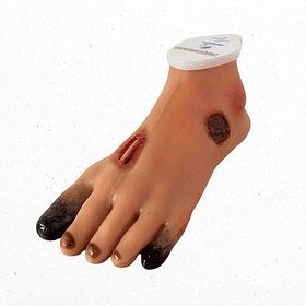 Simulador de pie diabético 